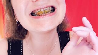 ASMR braces: giantess vore, eating jelly bears, chewing and swallowing, mouth fetish, Arya Grander