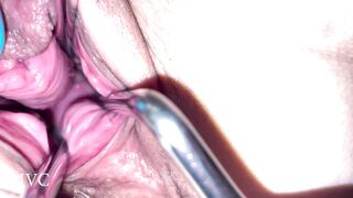 Fetish gyno vid with handjob cum